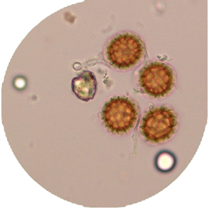 Durum ხორბლის Smut